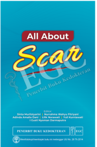 Image of All About Scar