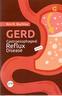 Image of GERD Gastroesophageal Reflux Disease