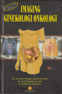 Image of Imaging ginekologi onkologi