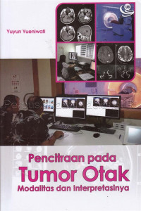 Image of Pencitraan pada tumor otak : modalitas dan interpretasinya