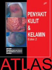 Image of Penyakit Kulit Dan Kelamin